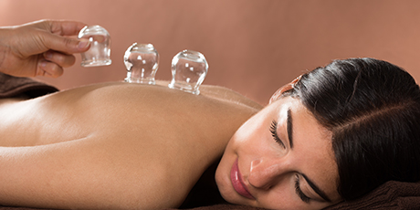 CUPPING